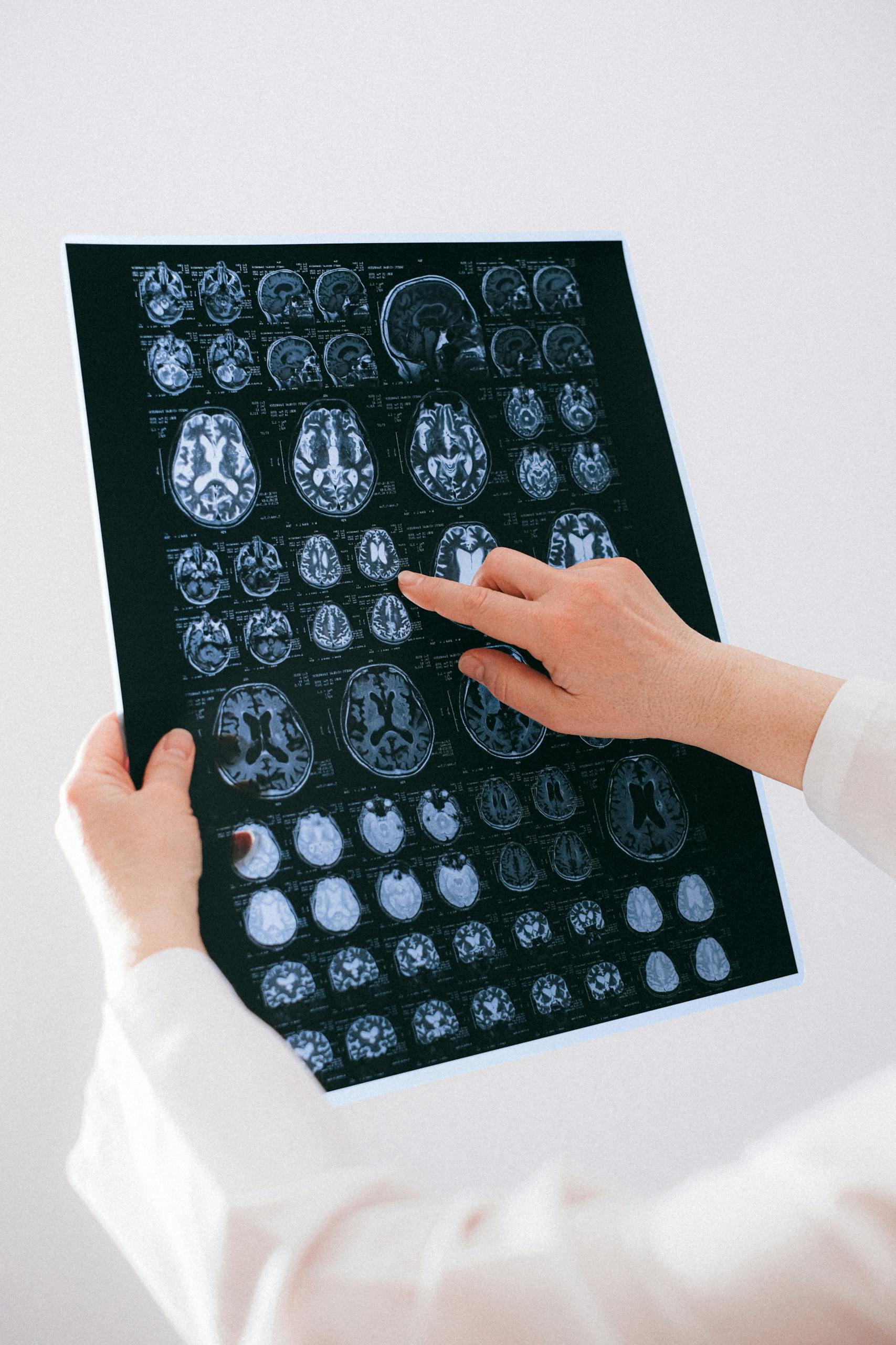 A medical professional examines a brain MRI scan, focusing on neurological health.