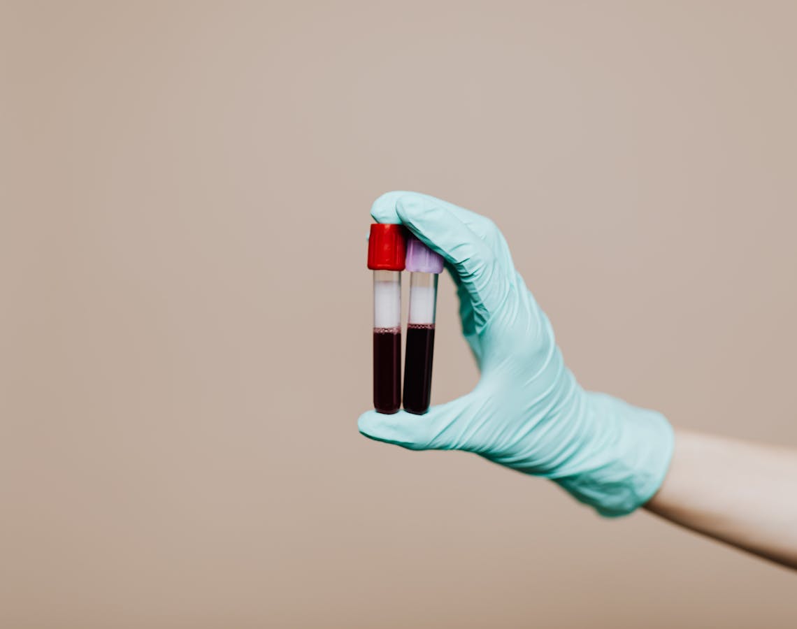 Photo Of Person Holding Test Tubes